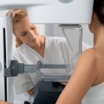 Igényfelmérés mammográfia szűréssel kapcsolatban